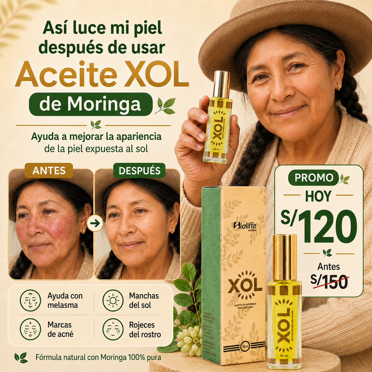 ACEITE DE XOL ACLARADOR